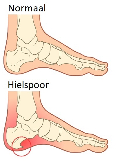 Hielspoor